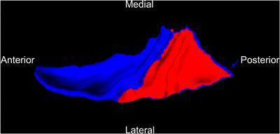 Structural MRI Study of the Planum Temporale in Individuals With an At-Risk Mental State Using Labeled Cortical Distance Mapping